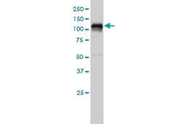HDAC7 antibody  (AA 1-276)