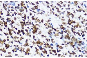 Immunohistochemistry of paraffin-embedded Human appendix using Acetyl-Histone H4-K12 Polyclonal Antibody at dilution of 1:200 (40x lens). (Histone H4 antibody  (acLys12))