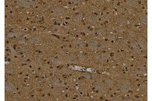 ABIN6264398 and ABIN6277092 at 1/100 staining Rat brain tissue by IHC-P.