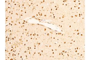 ABIN6267286 at 1/100 staining rat brain tissue sections by IHC-P. (TRKA antibody  (pTyr681, Tyr680))