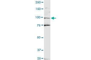 ZNF598 polyclonal antibody (A01). (ZNF598 antibody  (AA 28-126))