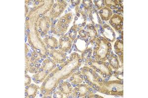 Immunohistochemistry of paraffin-embedded rat kidney using HSPD1 antibody. (HSPD1 antibody)