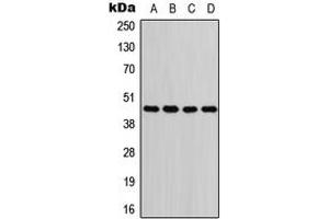 Western blot analysis of GOT1 expression in Jurkat (A), A549 (B), PC12 (C), H9C2 (D) whole cell lysates.