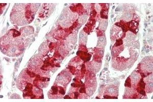 Detection of MUC6 in Human Stomach Tissue using Polyclonal Antibody to Mucin 6 (MUC6) (MUC6 antibody  (AA 2338-2439))