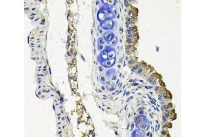 Immunohistochemistry of paraffin-embedded Mouse lung using MARK1 Polyclonal Antibody at dilution of 1:100 (40x lens).