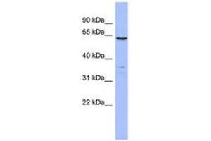 Image no. 1 for anti-Plastin 1 (PLS1) (AA 71-120) antibody (ABIN6744070) (PLS1 antibody  (AA 71-120))