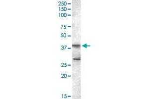 SKAP2 polyclonal antibody  staining (0. (SKAP2 antibody)