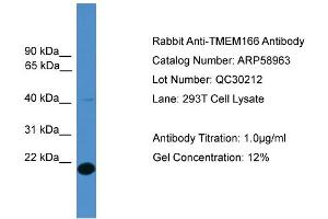 WB Suggested Anti-TMEM166  Antibody Titration: 0. (TMEM166 antibody  (Middle Region))