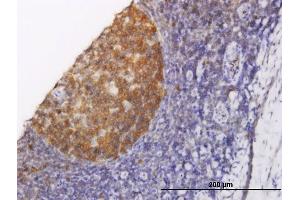 Immunoperoxidase of monoclonal antibody to NOLC1 on formalin-fixed paraffin-embedded human tonsil. (NOLC1 antibody  (AA 590-699))