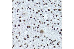 Immunohistochemistry of paraffin-embedded mouse liver using Phospho-ATR-T1989 Rabbit pAb (ABIN7265777) at dilution of 1:200 (40x lens). (ATR antibody  (pThr1989))