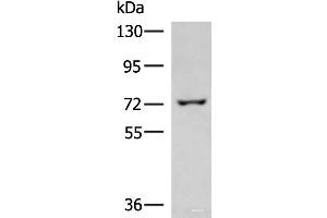 Western blot analysis of 293T cell lysate using GLS Polyclonal Antibody at dilution of 1:850 (Glutaminase antibody)