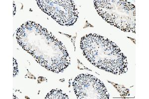 IHC analysis of MCM6 using anti-MCM6 antibody (ABIN7600037).