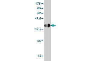 Western Blot detection against Immunogen (36. (HPSE antibody  (AA 72-170))