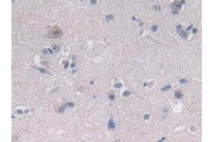 Detection of OAS2 in Human Cerebrum Tissue using Polyclonal Antibody to 2',5'-Oligoadenylate Synthetase 2 (OAS2)