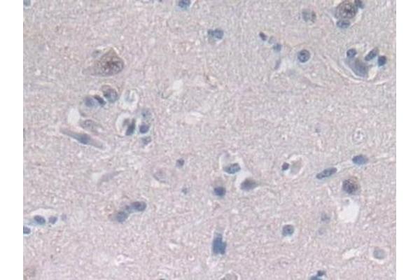 OAS2 antibody  (AA 11-346)