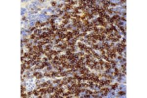 Immunohistochemistry (Paraffin-embedded Sections) (IHC (p)) image for anti-CD3 (CD3) antibody (ABIN7073386)