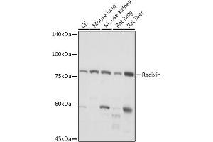 Western blot analysis of extracts of various cell lines, using Radixin Rabbit mAb (ABIN7269833) at 1:1000 dilution. (Radixin antibody)