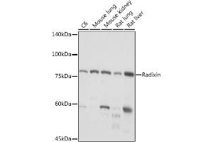 Western blot analysis of extracts of various cell lines, using Radixin Rabbit mAb (ABIN7269833) at 1:1000 dilution.