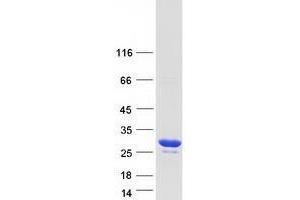 Tumor Protein D52-Like 2 (TPD52L2) (Transcript Variant 6) protein (Myc-DYKDDDDK Tag)