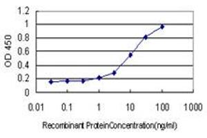 Detection limit for recombinant GST tagged LAMC1 is approximately 0. (Laminin gamma 1 antibody  (AA 1-38))