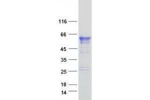 Validation with Western Blot (TMPRSS4 Protein (Transcript Variant 1) (Myc-DYKDDDDK Tag))