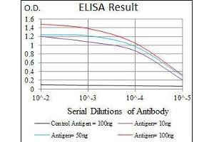 Black line: Control Antigen (100 ng), Purple line: Antigen(10 ng), Blue line: Antigen (50 ng), Red line: Antigen (100 ng), (JNK antibody)