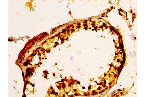 IHC image of ABIN7174678 diluted at 1:100 and staining in paraffin-embedded human testis tissue performed on a Leica BondTM system. (ULBP1 antibody  (AA 26-216))