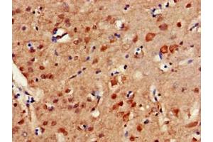 Immunohistochemistry of paraffin-embedded human brain tissue using ABIN7150279 at dilution of 1:100 (ERCC4 antibody  (AA 656-753))