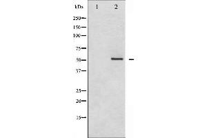 Western blot analysis of HDAC2 phosphorylation expression in NIH-3T3 whole cell lysates,The lane on the left is treated with the antigen-specific peptide.