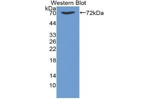 Detection of Recombinant HSPA1B, Bovine using Monoclonal Antibody to Heat Shock 70 kDa Protein 1B (HSPA1B) (HSPA1B antibody  (AA 1-641))