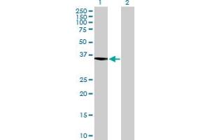ASTE1 antibody  (AA 1-320)