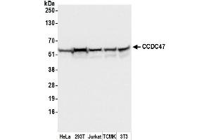 anti-Coiled-Coil Domain Containing 47 (CCDC47) (AA 1-50) antibody