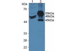 Western blot analysis of (1) Human HeLa cells and (2) Porcine Intestine Tissue. (KRT20 antibody  (AA 9-424))