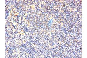 Immunohistochemistry of paraffin-embedded human lymphoid tissue using ABIN7171334 at dilution of 1:100 (CD7 antibody  (AA 26-180))