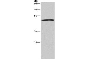 Western Blot analysis of 293T cell using HTR2B Polyclonal Antibody at dilution of 1:500 (Serotonin Receptor 2B antibody)