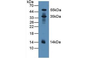 Detection of PDXK in Human Lung Tissue using Polyclonal Antibody to Pyridoxal Kinase (PDXK) (PDXK antibody  (AA 29-253))