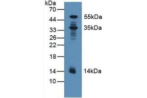 Detection of PDXK in Human Lung Tissue using Polyclonal Antibody to Pyridoxal Kinase (PDXK)