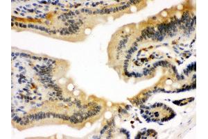 Anti- STAT1 Picoband antibody, IHC(P) IHC(P): Mouse Intestine Tissue (STAT1 antibody  (N-Term))