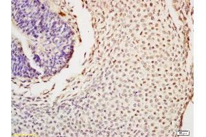 Formalin-fixed and paraffin embedded mouse tooth germ tissue labeled with Anti-Nanog Polyclonal Antibody , Unconjugated at 1:200, followed by conjugation to the secondary antibody and DAB staining (Nanog antibody  (AA 71-170))