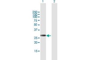 Western Blot analysis of IGFBP4 expression in transfected 293T cell line by IGFBP4 MaxPab polyclonal antibody. (IGFBP4 antibody  (AA 1-258))