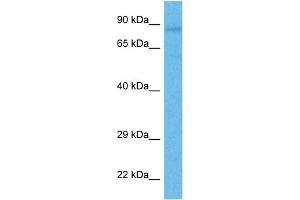 Host:  Rabbit  Target Name:  RIPK4  Sample Tissue:  Human HT1080 Whole Cell  Antibody Dilution:  1ug/ml (RIPK4 antibody  (Middle Region))
