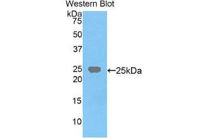 Western Blotting (WB) image for anti-Farnesyl-Diphosphate Farnesyltransferase 1 (FDFT1) (AA 217-416) antibody (ABIN3206187) (FDFT1 antibody  (AA 217-416))