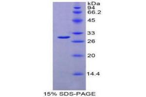 SDS-PAGE (SDS) image for Interferon alpha/beta Receptor 1 (IFNAR1) (AA 104-341) protein (His tag) (ABIN1879548)