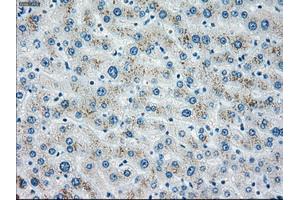 Immunohistochemical staining of paraffin-embedded liver tissue using anti-CHEK2mouse monoclonal antibody.