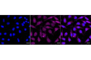 Immunocytochemical staining of Hela cells with Protein arginine methyltransferase 5 antibody (ABIN7799971), 1:1,000). (Recombinant PRMT5 antibody)