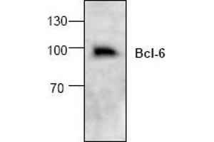 Image no. 1 for anti-B-Cell CLL/lymphoma 6 (BCL6) (C-Term) antibody (ABIN127089) (BCL6 antibody  (C-Term))