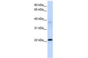 Image no. 1 for anti-Chromosome 11 Open Reading Frame 74 (C11ORF74) (C-Term) antibody (ABIN6741150) (C11ORF74 antibody  (C-Term))