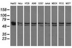 Image no. 3 for anti-Pantothenate Kinase 2 (PANK2) antibody (ABIN1500026) (PANK2 antibody)