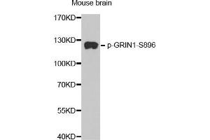 Western Blotting (WB) image for anti-Glutamate Receptor, Ionotropic, N-Methyl D-Aspartate 1 (GRIN1) (pSer896) antibody (ABIN3019689) (GRIN1/NMDAR1 antibody  (pSer896))