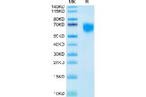 Biotinylated Human FGFR4 on Tris-Bis PAGE under reduced condition. (FGFR4 Protein (His-Avi Tag,Biotin))